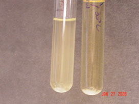 MRVP Agglutination Test Tubes