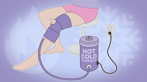 illustration of a water-circulating hot/cold therapy device strapped onto a young woman's leg around her knee and plugged into an electrical outlet