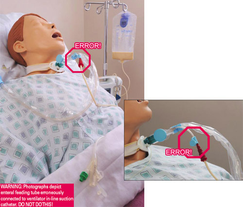 Enteral feeding tube erroneously connected to ventilator in-line suction catheter on a mannequin.