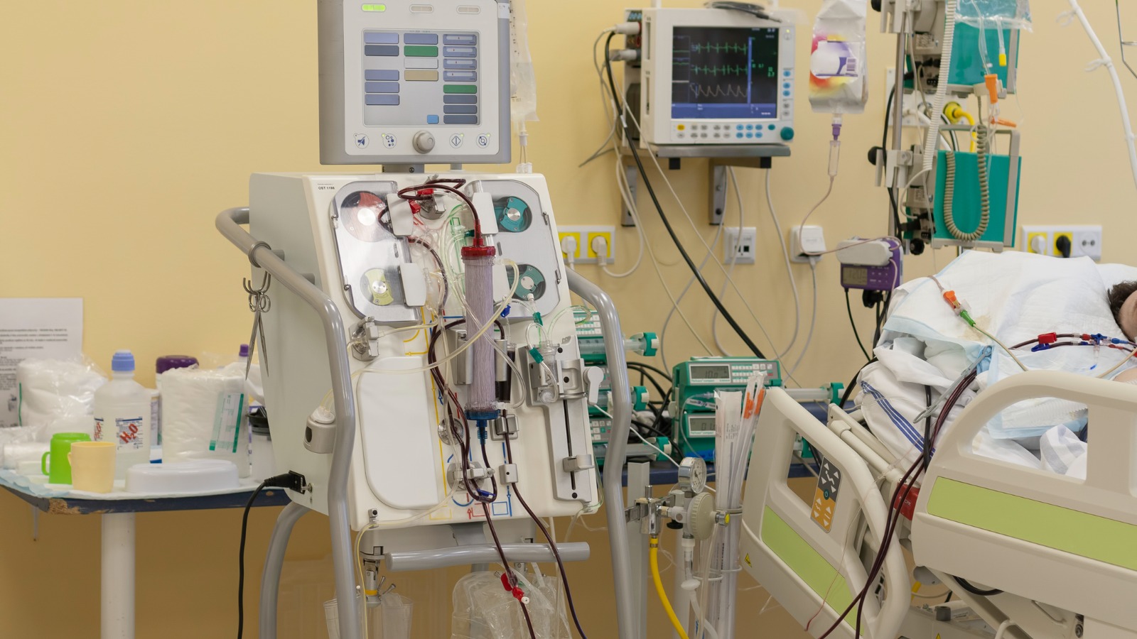 Incorrect dialysate canister mix-up during hemodialysis therapy