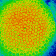 Cryo-Transmission Electron Microscopy (TEM) image of liposomes