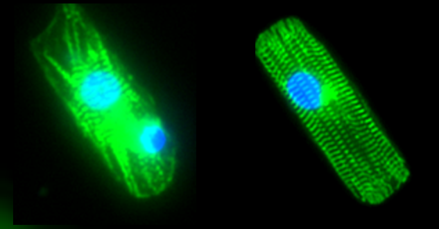 Single cardiac myocytes derived from human induced pluripotent stem cells are microengineered to have the properties of mature cardiac myocytes. The figure shows single cardiomyocytes with &alpha;-actinin labeled in green and the nucleus labeled in blue. The stem cell-derived myocyte on the left lacks key properties related to &alpha;-actinin organization and expression, while the microengineered stem cell-derived myocyte on the right has physiological organization and expression of &alpha;-actinin.