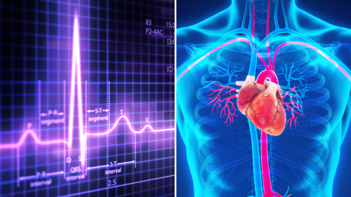 Graphic depicting an EKG and the human heart