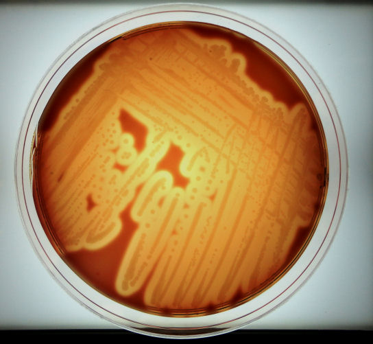 Figure 11.  Example of hemolysis on SHIBAM caused by an E. coli strain carrying the alpha-(α)hemolysin (α-hly) gene.