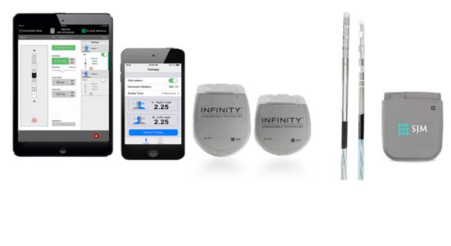 The Abbott InfinityTM DBS Neurostimulation System is an implantable device that delivers low-intensity electrical pulses to nerve centers in the brain using different combinations of amplitude, pulse width, and frequency. 