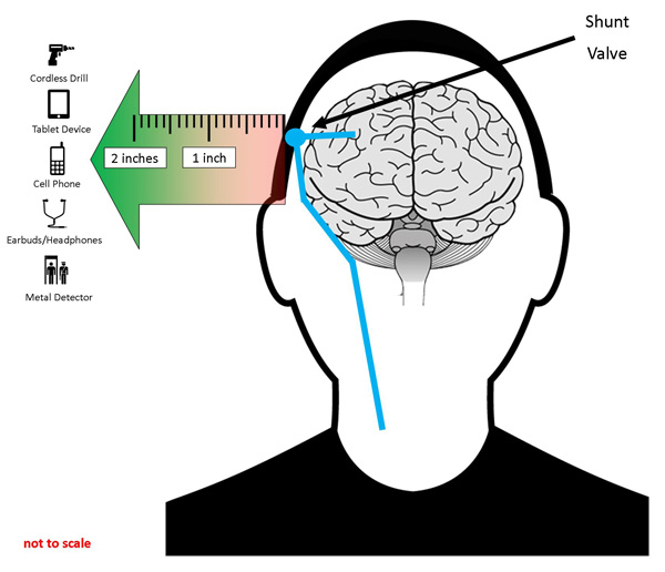 Diagram of a head with shunt and proximity to common magnetic sources.