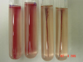 Motility Test Medium with TTC