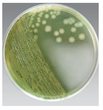 The bacteria produces a tell-tale green pigment when in the presence of the antiseptic cetrimide. This color reveal helps FDA scientists positively i.d. the pathogen when they’re working to solve frightening outbreaks.  