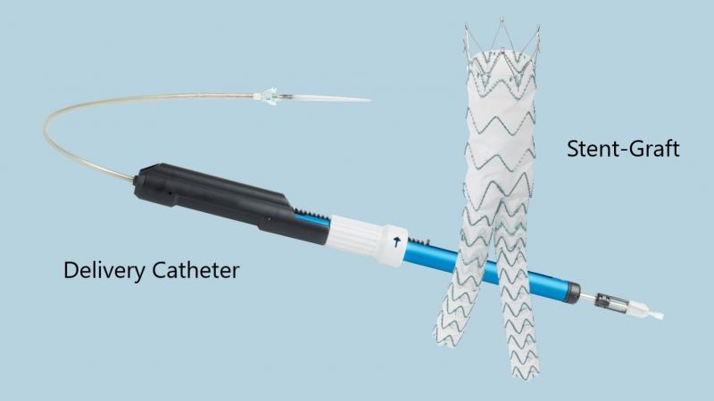 image of TREO® Abdominal Stent-Graft System – P190015