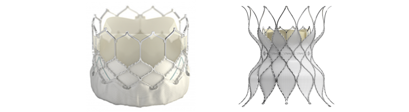 Edwards SAPIEN 3 Transcatheter Pulmonary Valve System with Alterra Adaptive Prestent – P200015/S011