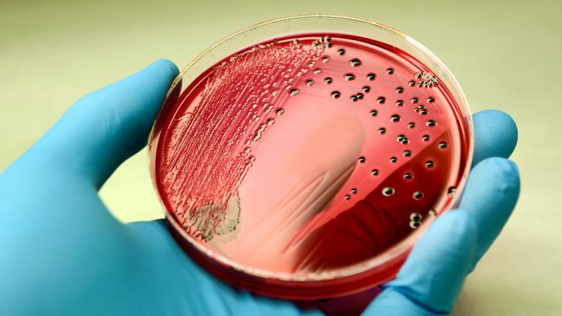  Salmonella bacteria producing red colonies with black center on an agar plate
