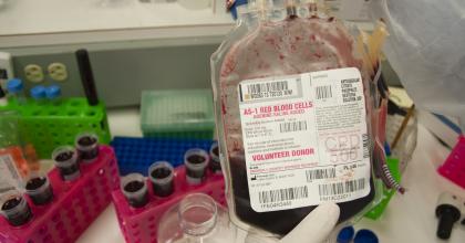 Blood Storage Research