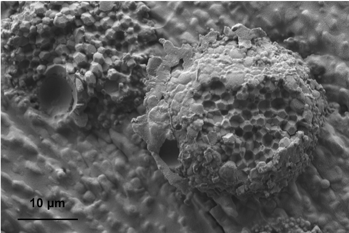 Figure 4. Cryo-SEM of multi-vesicular bupivacaine liposome showing its “honeycomb” structure (courtesy of Dr. Yong Wu and Dr. Jiwen Zheng).