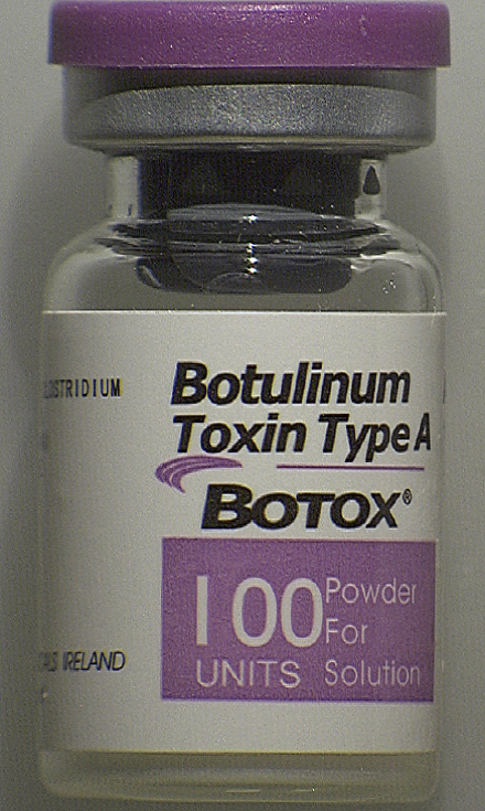 Counterfeit Vial of Botox (front)