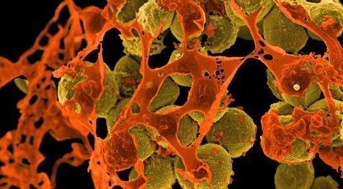 Scanning electron micrograph of methicillin-resistant Staphylococcus aureus (MRSA, brown) surrounded by cellular debris. MRSA resists treatment with many antibiotics. Credit: NIAID