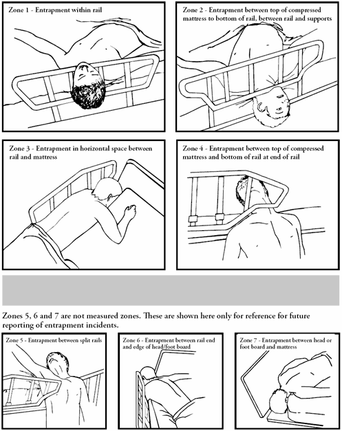 Zone 1, entrapment within rail. Zone 2, entrapment between top of compressed mattress to bottom of rail, between rail and supports. Zone 3, entrapment in horizontal space between rail and mattress. Zone 4, entrapment between top of compressed mattress and bottom of rail at end of rail. ... Zones 5, 6, and 7 are not measured zones. These are shown here only for reference for future reporting of entrapment incidents. Zone 5, entrapment between split rails. Zone 6, entrapment between rail end and edge of head or foot board. Zone 7, entrapment between head or foot board and mattress.