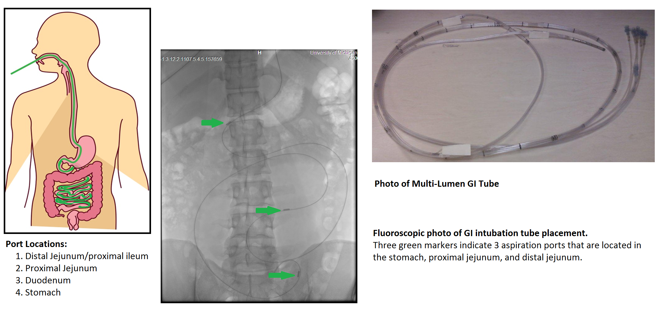 Figure 13. Correlation of mesalamine pharmacokinetics with local availability