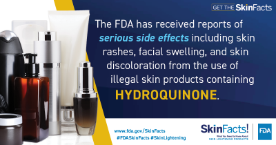 The FDA has received reports of serious side effects including skin rashes, facial swelling, and skin discoloration from the use of illegal skin products containing hydroquinone. 