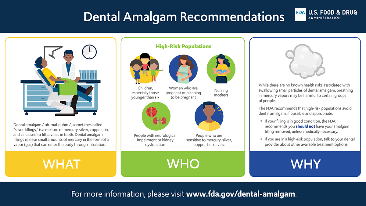 Dental Amalgam Fillings Graphic
