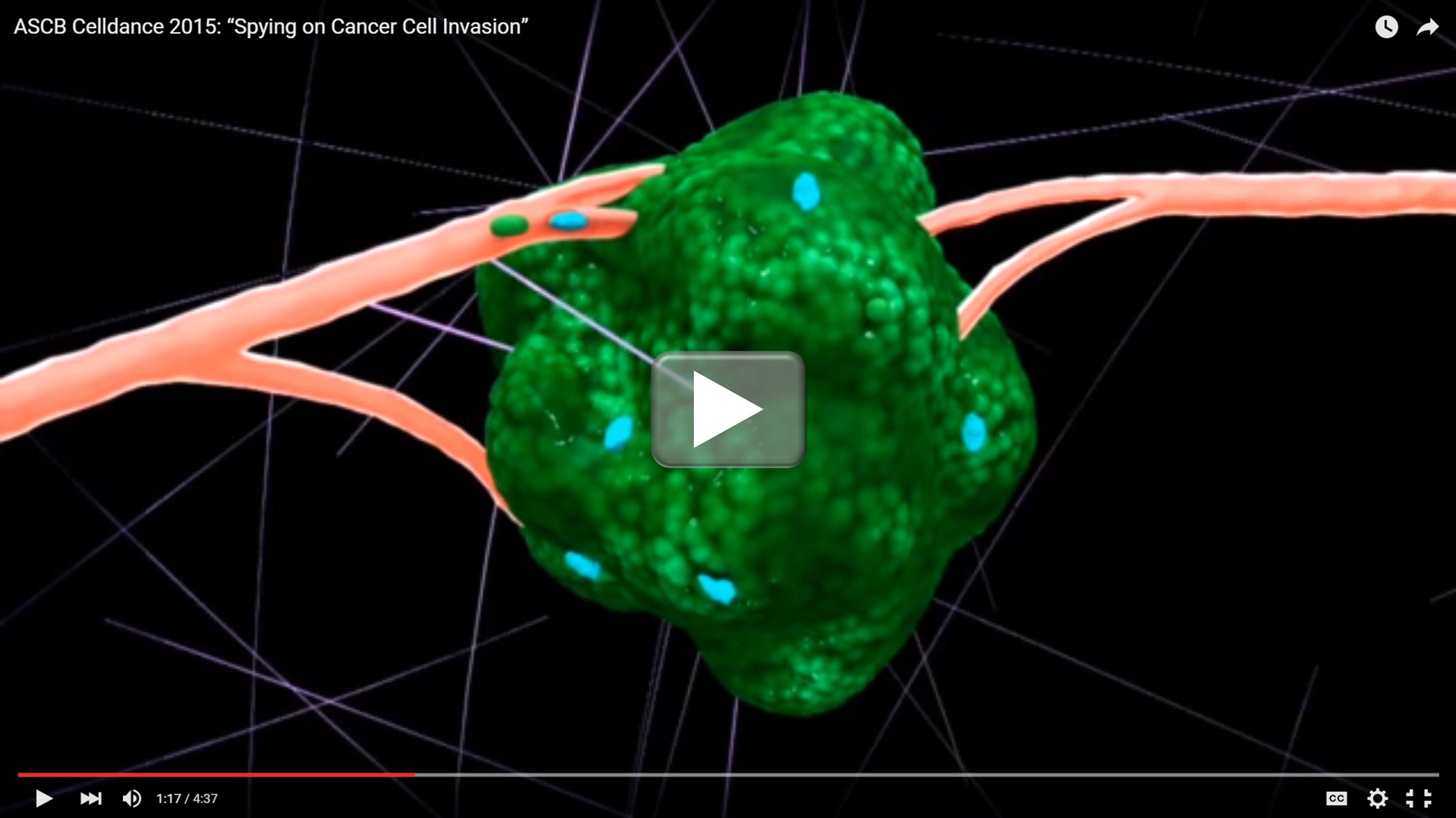 Spying on Cancer Cell Invation