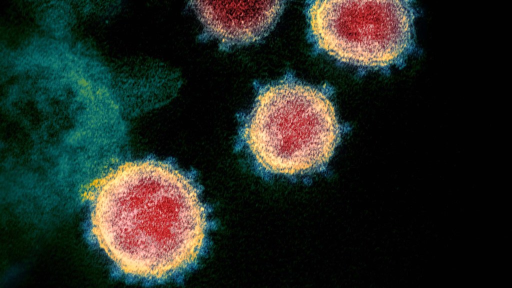 electron micrograph of COVID-19 viruses