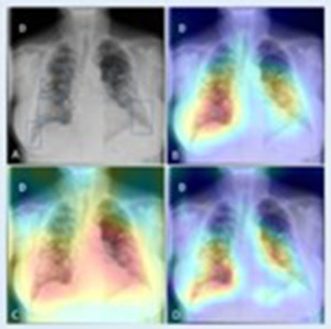 Four chest x-rays