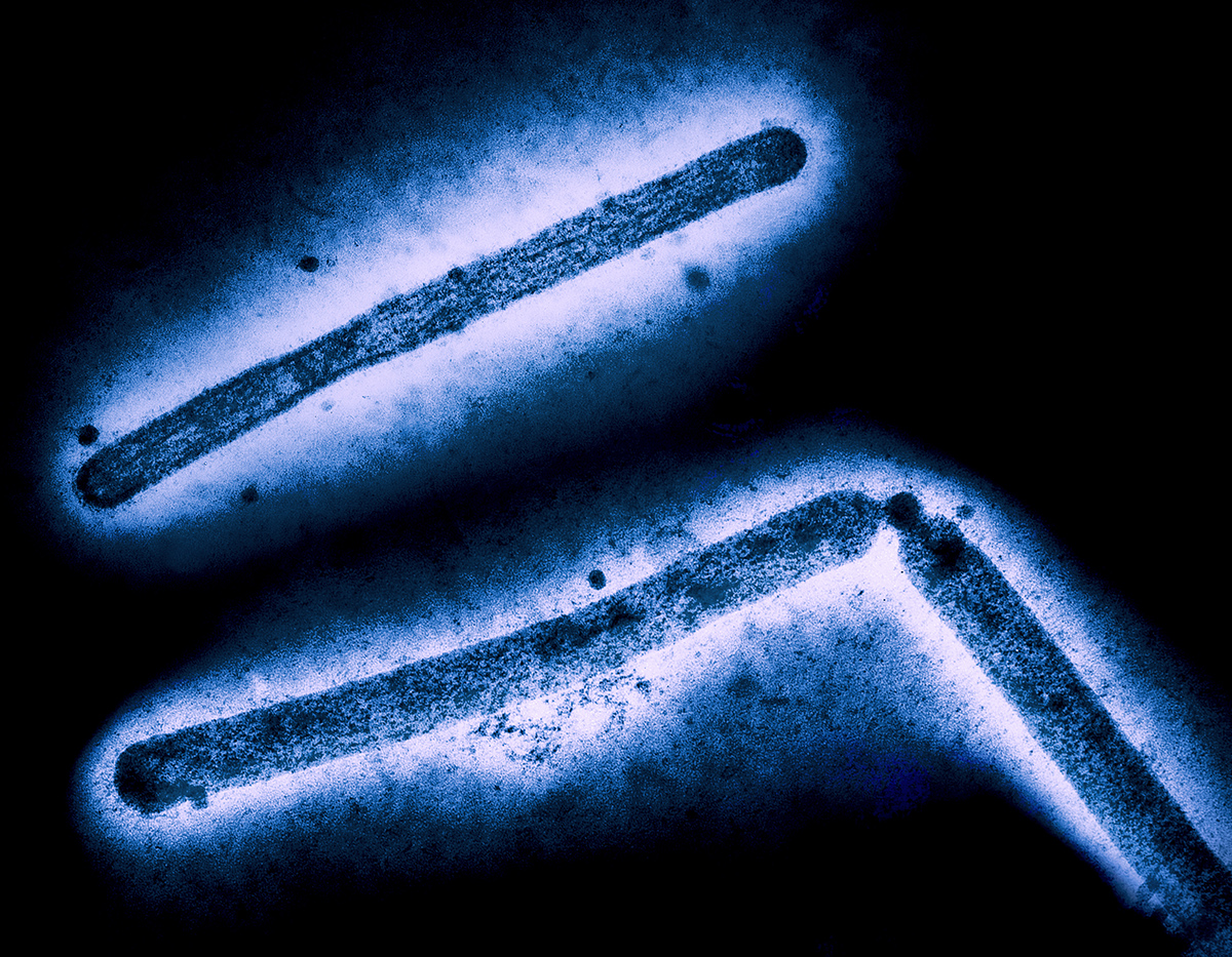 Three blue rod-shaped H5N1 influenza A virus particles on a black background.