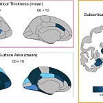 Three panels showing plots of the brain. Panel A shows mean cortical thickness, Panel B shows mean surface area, and Panel C shows mean subcortical volume